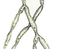 Abwasserpilz